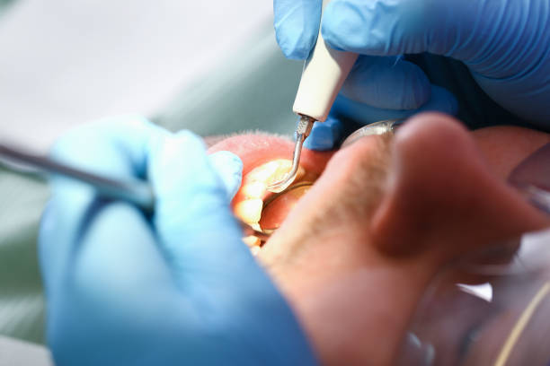Best Orthodontic Emergency Dentist in Carnegie, OK