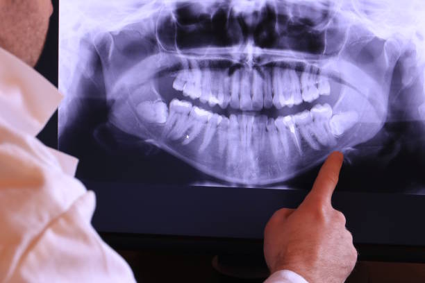 Best Emergency Dentist for Knocked-Out Tooth in Carnegie, OK